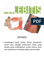 PHLEBITIS