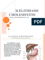 Cholelithiasis-Cholecystitis