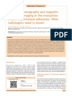 Radiologi ileus