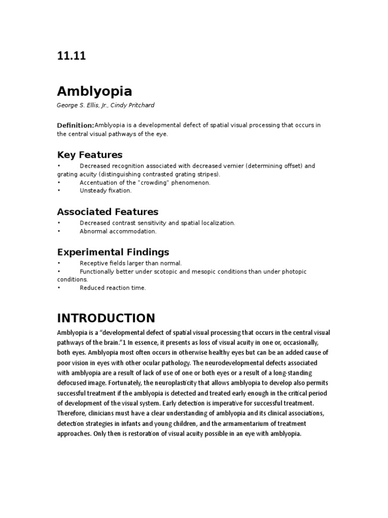 Ce este Astigmatismul: definiție, simptome, diagnostic și tratament | Blog marigold.ro