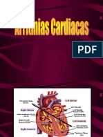 Arritmias en la emergencia: clasificación y manejo odontológico