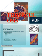 Tuberculosis.pptx