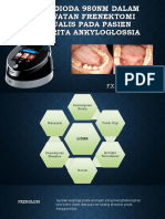 CERIL Frenectomy Lingualis