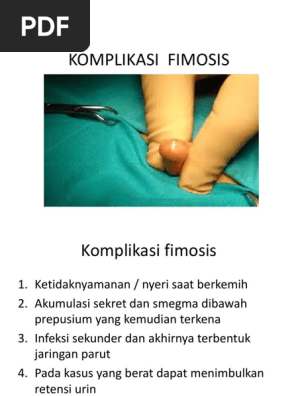 Katta piyoz fohishalari