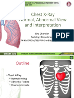 Chest X Ray Normal, Abnormal Views, and Interpretation