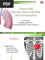 Chest X Ray Normal, Abnormal Views, and Interpretation