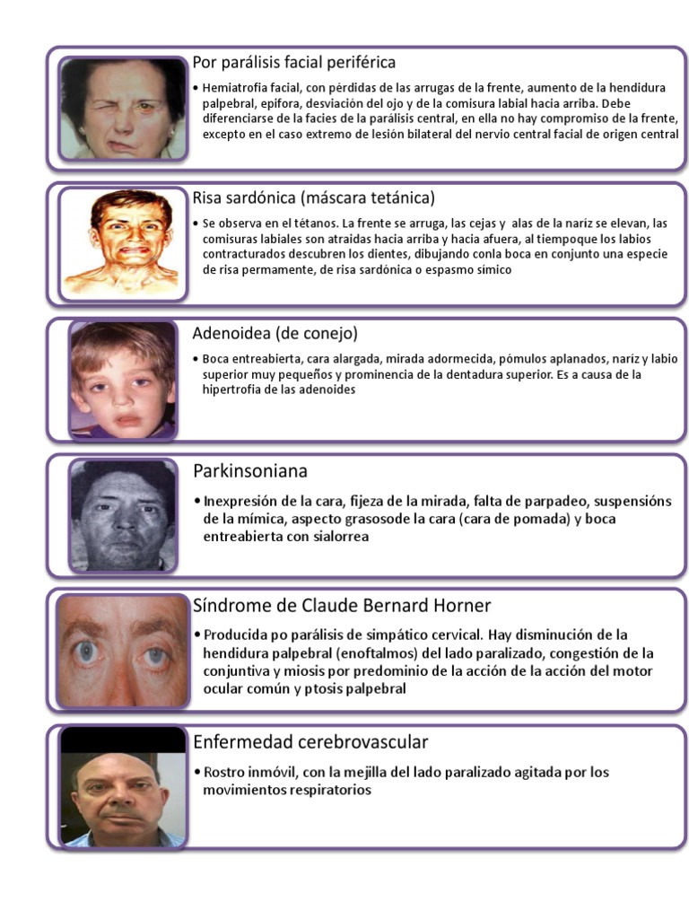 Facies patognomónicas en diferentes enfermedades | PDF | Enfermedades y ...
