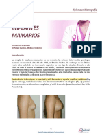 M6ACT2LOB01_implantes_mamarios
