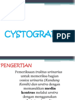 Cystografi DN Uretocystografi