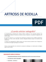 Artrosis de Rodilla