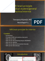 MRI Brain - Neurologist P Ed.V