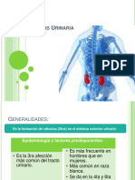 Litiasis Renal