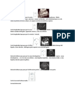 Corte Longitudinal Que Pasa Por La Aorta