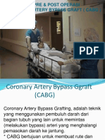 PERIOP - CABG - 2016.ppt Filename - UTF-8''PERIOP CABG 2016