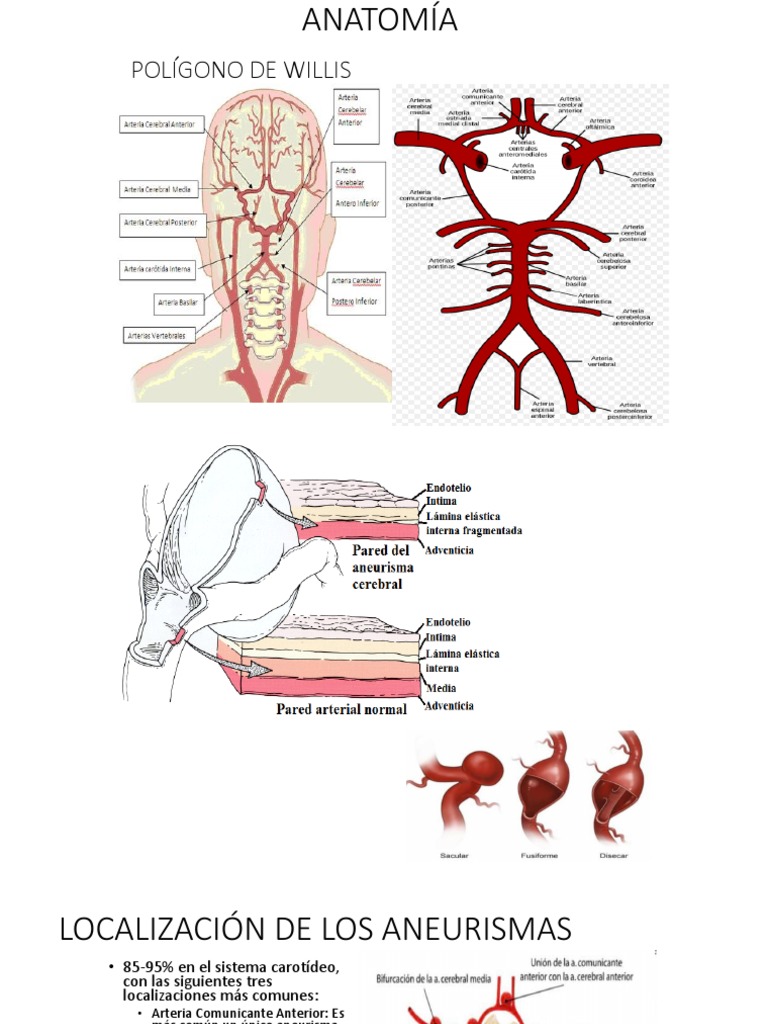 ANEURISMA | PDF | Neurología | Enfermedades y trastornos humanos, image size:768x1024