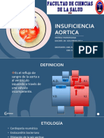 Insuficiencia Aortica