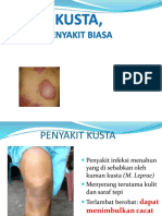 Kusta Peny Biasa