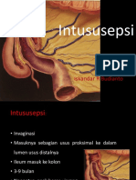 Intususepsi Is