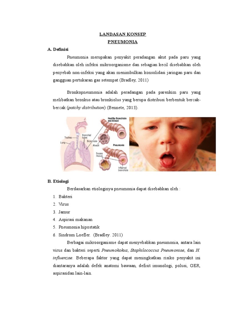 LP Pneumonia Pada Anak | PDF