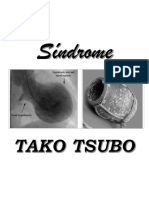 Sindrome de TAKO TSUBO 