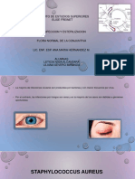 Infecciones oculares: causas, síntomas y tratamientos