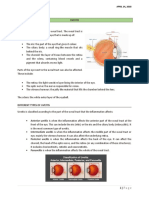 Uveitis and Iritis