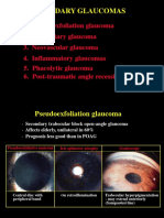 30secondary Glaucomas