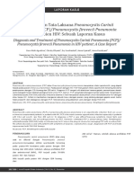 Diagnosis Dan Tata Laksana Pneumocystis Carinii-Jurnal Peny Dalam Ind