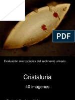 Evaluacion de Cristaluria PDF