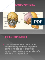 CRANEOPUNTURA.pptx