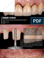 Tallado vertical.pptx