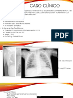 Bronquiolitis Obliterante en La Edad Pediátrica