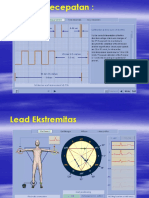 Elektrokardiogram