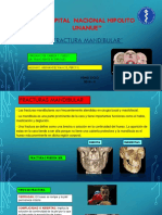 FX Mandibular