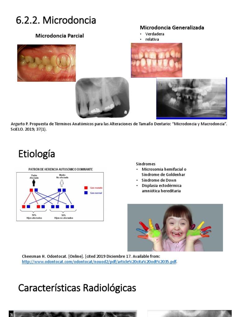 Microdoncia PDF Diente Ciencias de la Salud