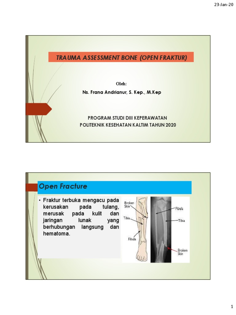Trauma Assessment Bone (Open Fraktur) | PDF