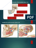 TEMPORAL AND INFRATEMPORAL FOSSAE Lecture-1