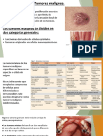tumores malignos.pptx