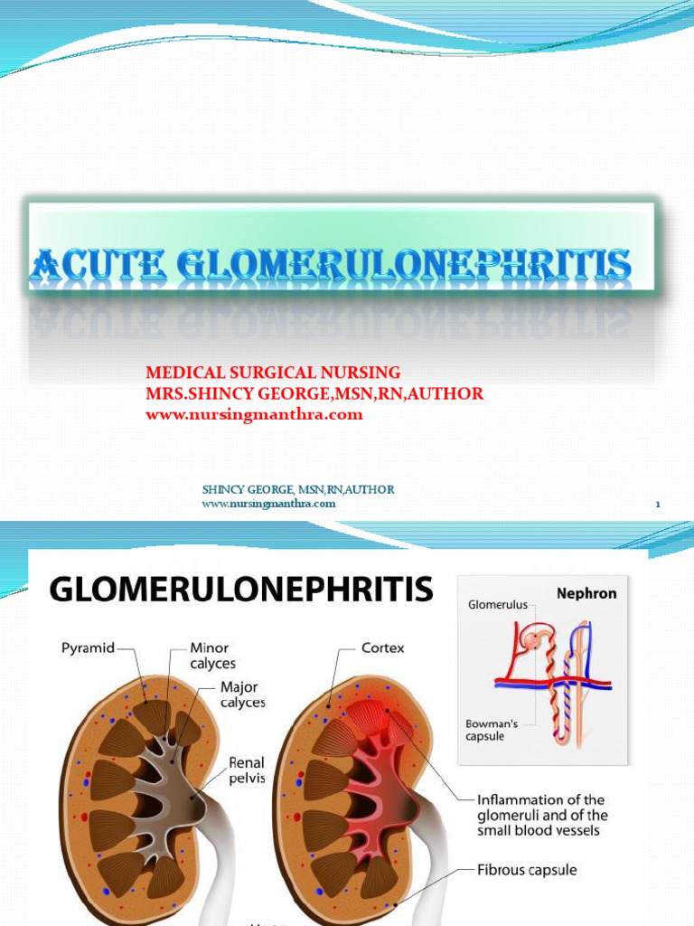 Acute Glomerulonephritis | PDF | Kidney | Medical Specialties
