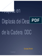 M26 Martel. Pesquisa de Displasia de Cadera PDF