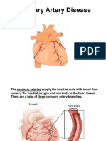 Coronary Heart Disease