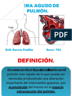 Cap. 52 Edema pulmonar.pptx