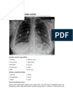 X-ray Anatomi