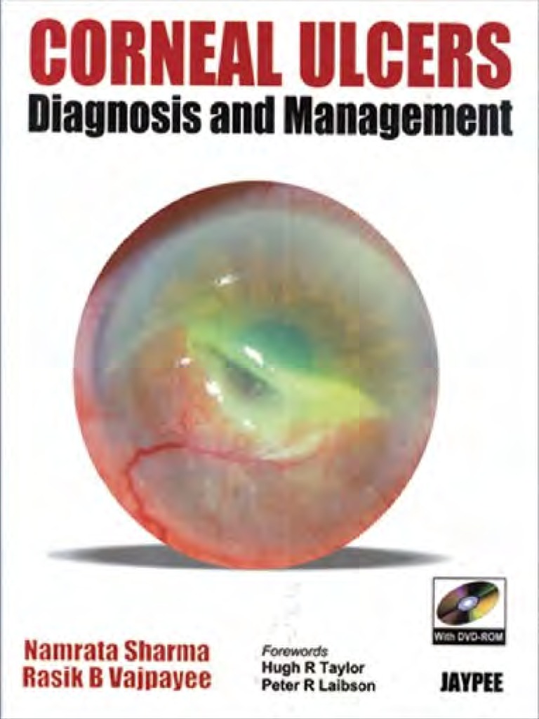Corneal Ulcers PDF | PDF | Cornea | Epithelium