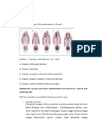 CLEFT TYPE-TREATMENT siska