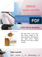 Neuritis Optikus
