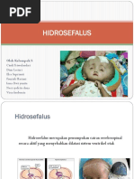 ppt HIDROSEFALUS-1