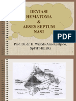 Deviasi, Hematoma & Abses Septum Nasi