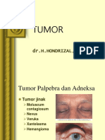 Tumor Orbita