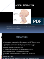 Endotracheal Intubation: A Step-by-Step Guide